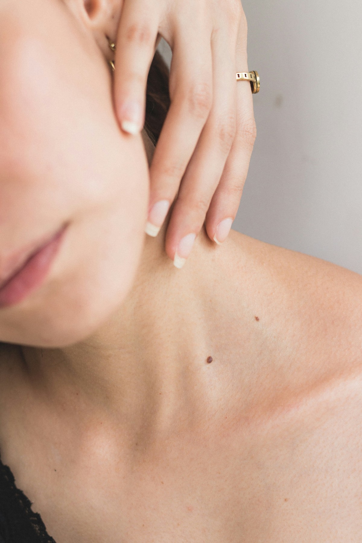 Skin Tags & Benign Lesions preview article image